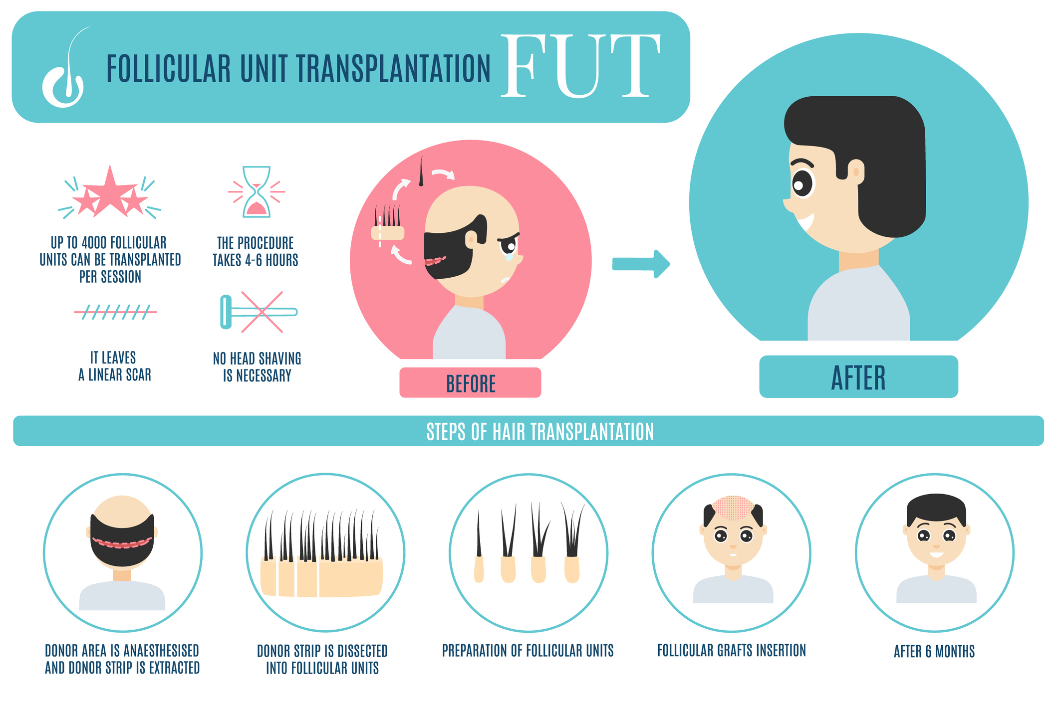 FUT Hair Treatment Niagara Falls